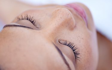 Natural looking eyelashes with Latisse